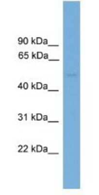 Western Blot: PPP2R5E Antibody [NBP1-79638]