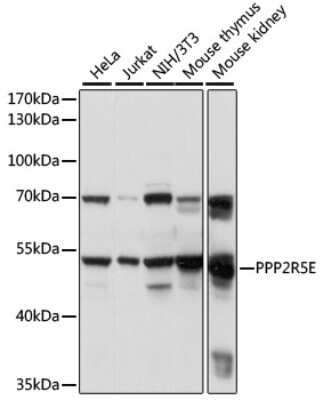 Western Blot: PPP2R5E AntibodyAzide and BSA Free [NBP2-95166]