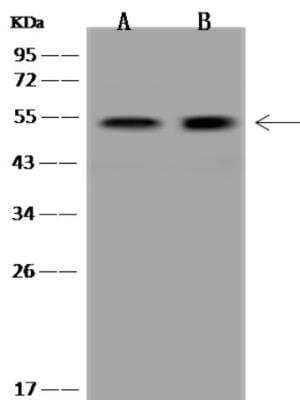 Western Blot: PPP2R5E Antibody [NBP3-06478]