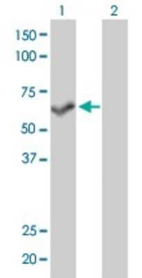 Western Blot: PPP3CB Antibody (5D3) [H00005532-M01]