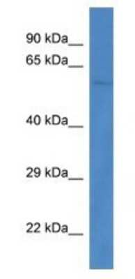 Western Blot: PPP3CB Antibody [NBP1-74253]