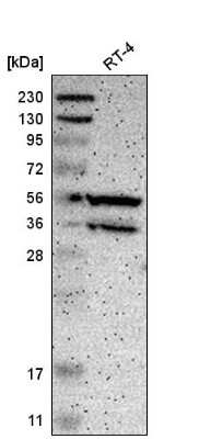 Western Blot: PPP3CB Antibody [NBP2-58920]