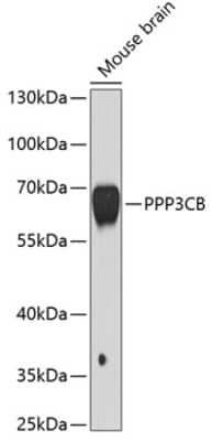 Western Blot: PPP3CB AntibodyBSA Free [NBP2-94864]