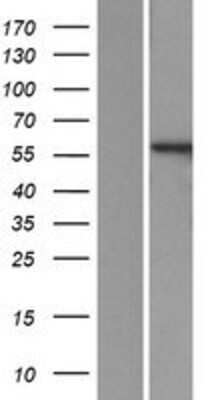 Western Blot: PPP3CB Overexpression Lysate [NBP2-06563]