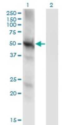 Western Blot: PPP3CC Antibody (4D1) [H00005533-M01]