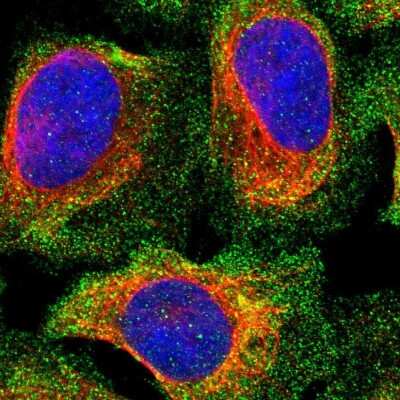 Immunocytochemistry/ Immunofluorescence: PPP3CC Antibody [NBP1-86656]