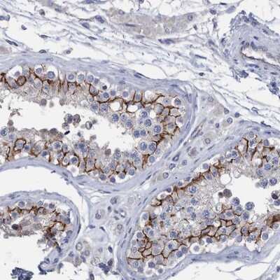 Immunohistochemistry-Paraffin: PPP3CC Antibody [NBP1-86656]