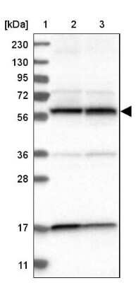 Western Blot: PPP3CC Antibody [NBP1-86656]