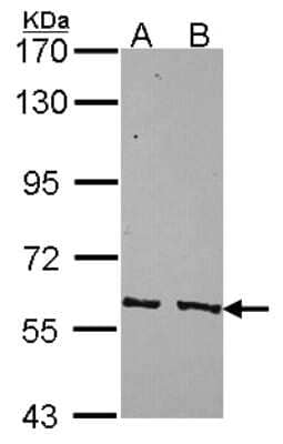 Western Blot: PPP3CC Antibody [NBP2-19911]