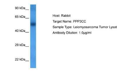 Western Blot: PPP3CC Antibody [NBP2-88086]