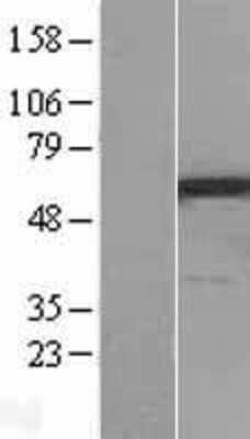 Western Blot: PPP3CC Overexpression Lysate [NBL1-14706]