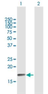 Western Blot: PPP3R2 Antibody [H00005535-B01P]