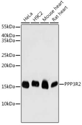 Western Blot: PPP3R2 AntibodyBSA Free [NBP2-93211]