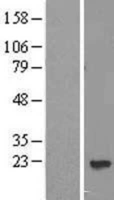 Western Blot: PPP3R2 Overexpression Lysate [NBL1-14708]