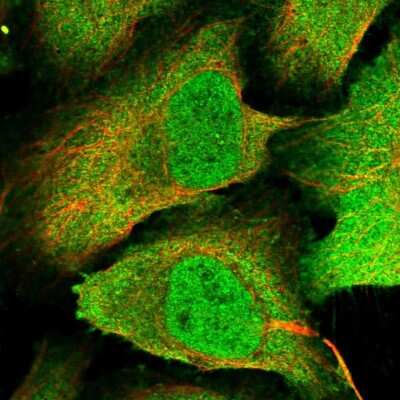 Immunocytochemistry/ Immunofluorescence: PP4/PPP4C Antibody [NBP2-13802]