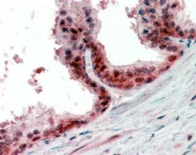 Immunohistochemistry-Paraffin: PP4/PPP4C Antibody [NBP1-51947]