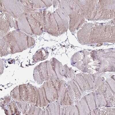 Immunohistochemistry-Paraffin: PP4/PPP4C Antibody [NBP2-13802]