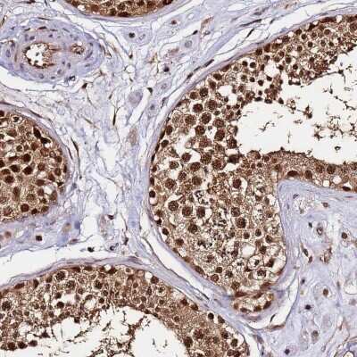 Immunohistochemistry-Paraffin: PP4/PPP4C Antibody [NBP2-13802]