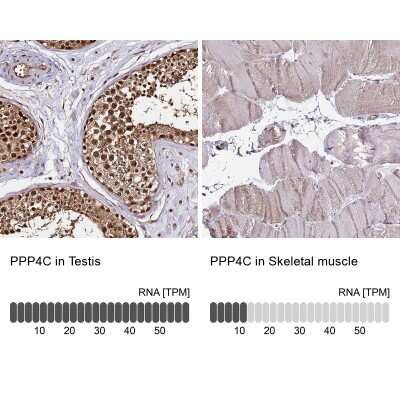 Immunohistochemistry-Paraffin: PP4/PPP4C Antibody [NBP2-13802]