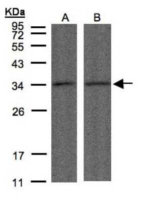 Western Blot: PP4/PPP4C Antibody [NBP1-31117]