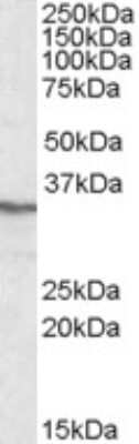 Western Blot: PP4/PPP4C Antibody [NBP1-51947]