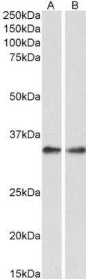 Western Blot: PP4/PPP4C Antibody [NBP1-51947]