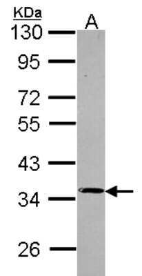 Western Blot: PP4/PPP4C Antibody [NBP2-19912]