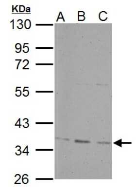 Western Blot: PP4/PPP4C Antibody [NBP2-19912]