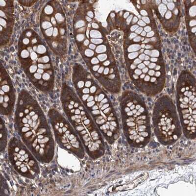 Immunohistochemistry-Paraffin: PPP4R1 Antibody [NBP1-87241]