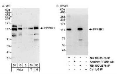 Western Blot: PPP4R1 Antibody [NB100-2875]