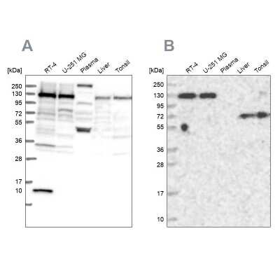 Western Blot: PPP4R1 Antibody [NBP1-87241]