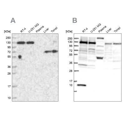 Western Blot: PPP4R1 Antibody [NBP1-87242]