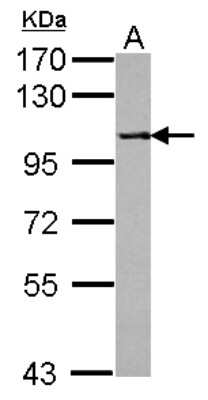 Western Blot: PPP4R1 Antibody [NBP2-19913]