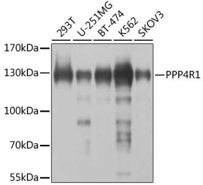 Western Blot: PPP4R1 AntibodyBSA Free [NBP2-94582]