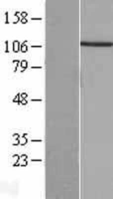 Western Blot: PPP4R1 Overexpression Lysate [NBL1-14710]