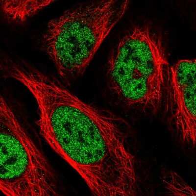 Immunocytochemistry/ Immunofluorescence: PPP4R2 Antibody [NBP2-38453]