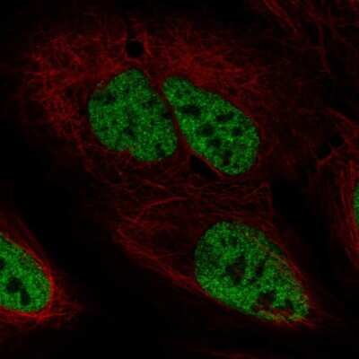 Immunocytochemistry/ Immunofluorescence: PPP4R2 Antibody [NBP2-58011]