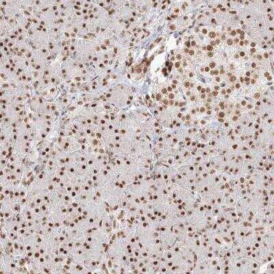 Immunohistochemistry-Paraffin: PPP4R2 Antibody [NBP1-89432]