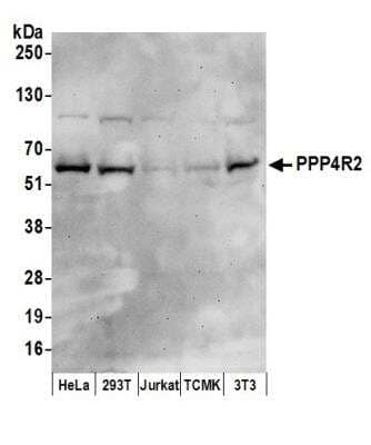 Western Blot: PPP4R2 Antibody [NB100-2877]