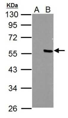 Western Blot: PPP4R2 Antibody [NBP2-19914]