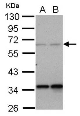 Western Blot: PPP4R2 Antibody [NBP2-19915]