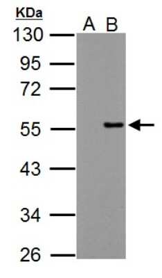 Western Blot: PPP4R2 Antibody [NBP2-19915]