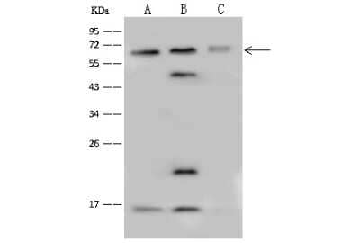 Western Blot: PPP4R2 Antibody [NBP2-99605]