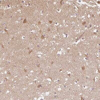 Immunohistochemistry-Paraffin: PPP4R4 Antibody [NBP2-48957]