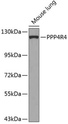 Western Blot: PPP4R4 AntibodyBSA Free [NBP2-94724]