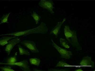 Immunocytochemistry/ Immunofluorescence: PPP6C Antibody [H00005537-B01P]