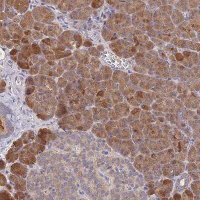 Immunohistochemistry-Paraffin: PPP6C Antibody [NBP2-13804]