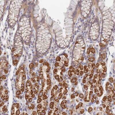 Immunohistochemistry-Paraffin: PPP6C Antibody [NBP2-13804]