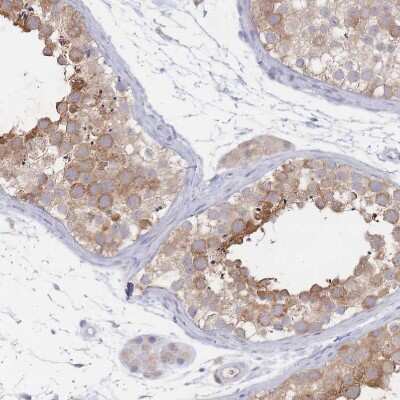 Immunohistochemistry-Paraffin: PPP6C Antibody [NBP2-13804]