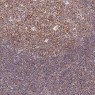 Immunohistochemistry-Paraffin: PPP6C Antibody [NBP2-13804]
